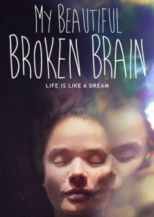 My Beautiful Broken Brain-My Beautiful Broken Brain