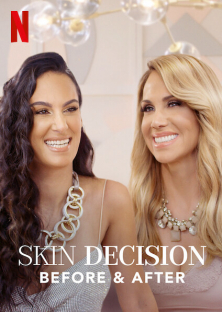 Skin Decision: Before and After-Skin Decision: Before and After